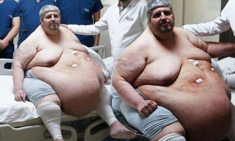 310 kiloya ulaştı! “Ölmek için dua ettim” dedi, yıllar sonra birinci adım 1 310 kiloya ulasti olmek icin dua ettim dedi yillar sonra birinci adim MY86xw1E