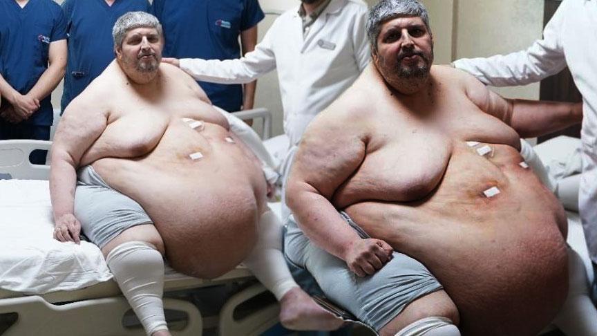 310 kiloya ulaştı! “Ölmek için dua ettim” dedi, yıllar sonra birinci adım