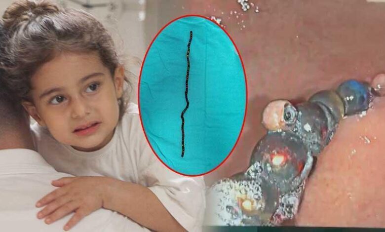 7 ay karnında taşıdı! 3 yaşındaki Berfin hekimleri şoke etti! 'Bu oyuncak değil, vefat tuzağıymış' 1 7 ay karninda tasidi 3 yasindaki berfin hekimleri soke etti bu oyuncak degil vefat WM9glGVx