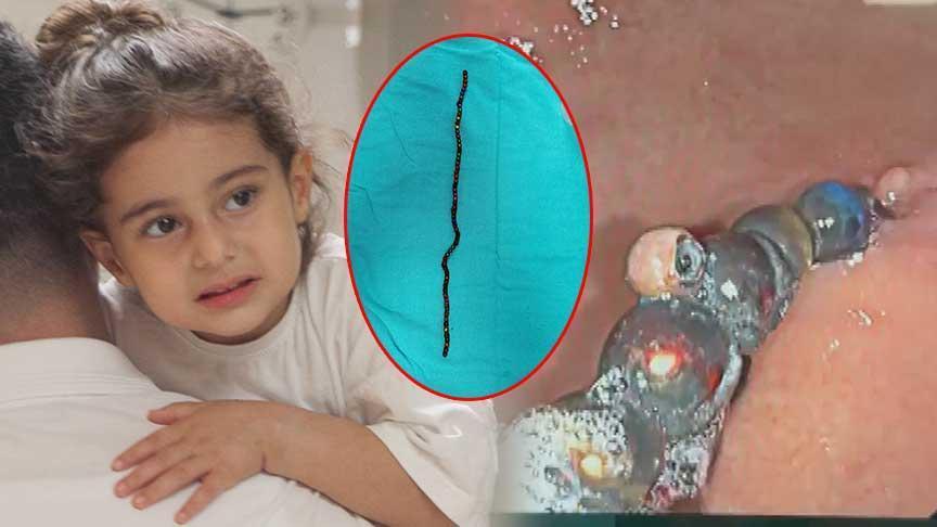 7 ay karnında taşıdı! 3 yaşındaki Berfin hekimleri şoke etti! ‘Bu oyuncak değil, vefat tuzağıymış’