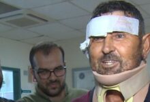 aslanin saldirdigi ciftci taburcu oldu sivrisinek isirmasin diye ustumu orttum aslan isirdi emyAGzDS