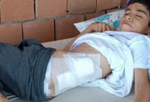 bahcede oynayan 8 yasindaki cocuk kanlar icerisinde yere yigildi xZDmP1g8