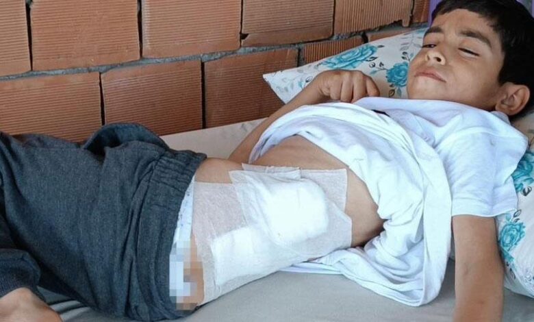 bahcede oynayan 8 yasindaki cocuk kanlar icerisinde yere yigildi xZDmP1g8