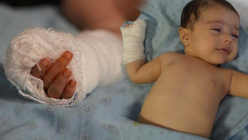 Hastane vahim olay! Serum çıkarılırken 3 aylık bebeğin parmağı koptu