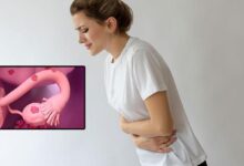 her 4 bayandan 1inin sorunu miyom riskini artiran ve azaltan etkenler var xUdpkyua