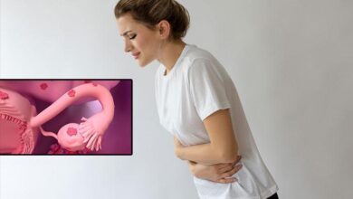 her 4 bayandan 1inin sorunu miyom riskini artiran ve azaltan etkenler var xUdpkyua
