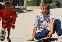 kaykayla hayata tutunmustu ayagindaki kemik yanlis kaynayan serdal artik yuruyebiliyor M7ETJpv8