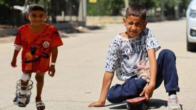 kaykayla hayata tutunmustu ayagindaki kemik yanlis kaynayan serdal artik yuruyebiliyor M7ETJpv8