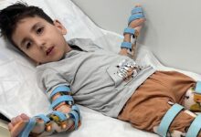 sivrisinek isirigi yataga bagimli hale getirmisti 8 yasindaki mehmet buyruk icin umut Kr1jAFWb