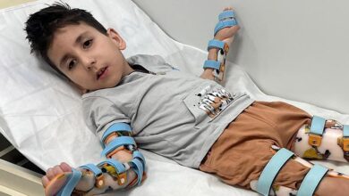 sivrisinek isirigi yataga bagimli hale getirmisti 8 yasindaki mehmet buyruk icin umut Kr1jAFWb