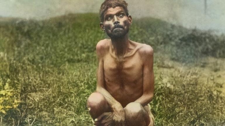 8 yaşında konuşamıyor, yalnızca havlıyor! Sinemaydı, gerçek oldu: 'Sebebi anne ve abisi' 4 8 yasinda konusamiyor yalnizca havliyor sinemaydi gercek oldu sebebi anne ve abisi 2 m9DfhztO