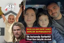 birinci morlugu kolunda gordu darp sandi gercek oburmus thordan buyuk takviye 7RsIgg7N