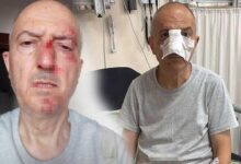 bosanma etabindaki esinin kardesi kabusu oldu asfalta dustum 4B4hVhvl