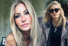 cagla sikelin bacaklari mosmor oldu nedeni ise yeni hobisi en hos yaz Sxuj2n4F