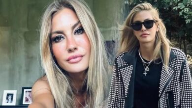 cagla sikelin bacaklari mosmor oldu nedeni ise yeni hobisi en hos yaz Sxuj2n4F