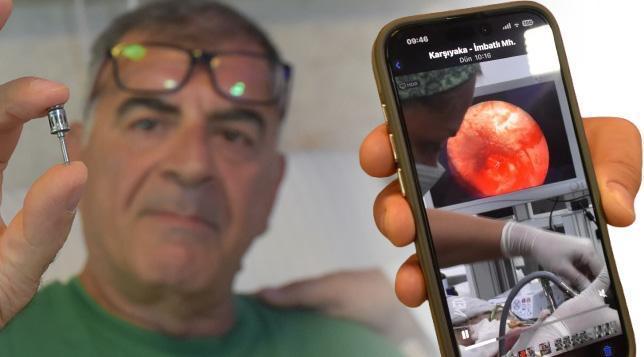Geçmeyen öksürüğün nedeni şaşkına çevirdi! Hekimler da şaşkın: Olağan değil 1 gecmeyen oksurugun nedeni saskina cevirdi hekimler da saskin olagan degil NkqawJV4