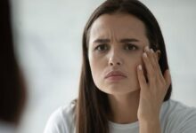 goz segirmesi konugun degil magnezyumun isareti kimse bilmiyor tahlili var UwTffEdw