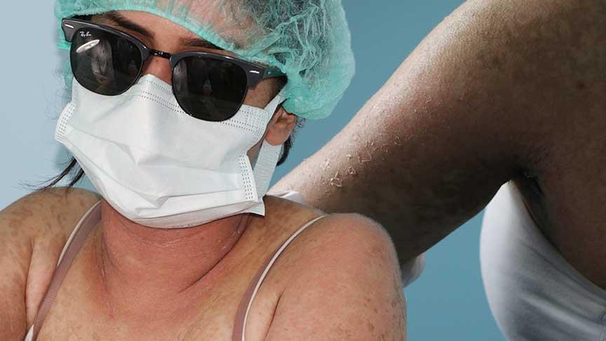 İnternetten sipariş verdiği krem hayatını kararttı! 4 gün ağır bakımda kaldı! ‘Kezzap üzere bir eser’