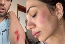 kopek besledi dehseti yasadi veteriner ve ailesine sok hucum annem 10 metre suruklendi tAk2GuyW
