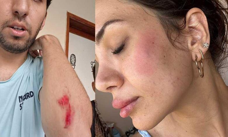 kopek besledi dehseti yasadi veteriner ve ailesine sok hucum annem 10 metre suruklendi tAk2GuyW