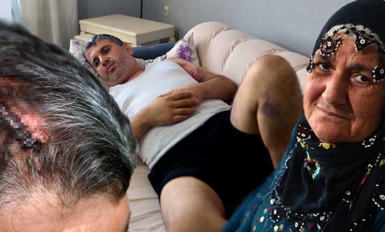 Miras hengamesi kanlı bitti: Dayısı beyzbol sopasıyla saldırdı: ‘Doğu adetinde bayana miras yok’ 1 miras hengamesi kanli bitti dayisi beyzbol sopasiyla saldirdi dogu adetinde bayana miras yok k7szd234