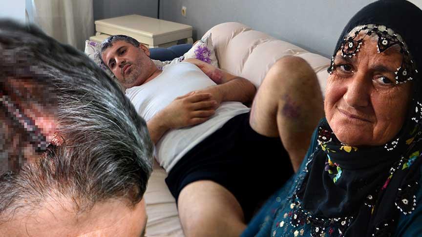 Miras hengamesi kanlı bitti: Dayısı beyzbol sopasıyla saldırdı: ‘Doğu adetinde bayana miras yok’