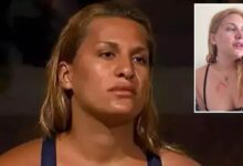 survivor almeda baylan kaza gecirdi o anlari ve son durumunu anlatti vefattan donduk gV7vOcSq