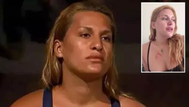 survivor almeda baylan kaza gecirdi o anlari ve son durumunu anlatti vefattan donduk gV7vOcSq