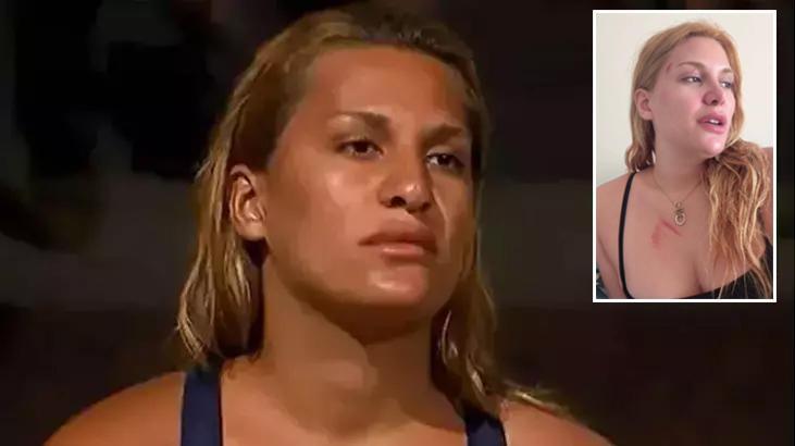 survivor almeda baylan vefattan donmustu aracin geldigi hali paylasti vzuikOU9