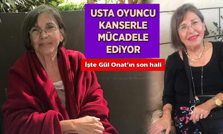 usta oyuncu kanserle savasiyor iste gul onatin son hali UpThXbmH