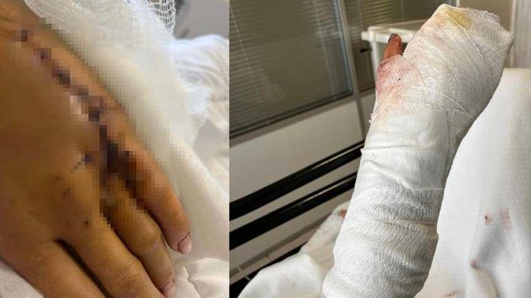 Uzaklaştırma kararı sonrası vahşet! Kafatasına zımba atıldı, elleri kırıldı: Plan yapıp beni öldürmeye geldi 4 uzaklastirma karari sonrasi vahset kafatasina zimba atildi elleri kirildi plan yapip beni oldurmeye geldi BDiJPMHl