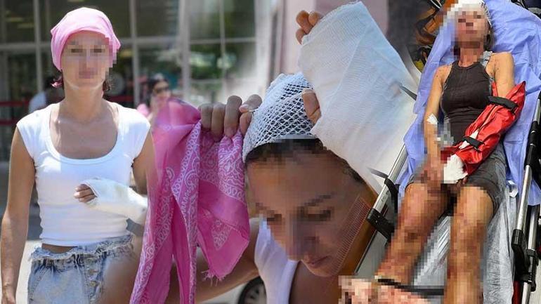 Uzaklaştırma kararı sonrası vahşet! Kafatasına zımba atıldı, elleri kırıldı: Plan yapıp beni öldürmeye geldi 2 uzaklastirma karari sonrasi vahset kafatasina zimba atildi elleri kirildi plan yapip beni oldurmeye geldi FRt9NfVF