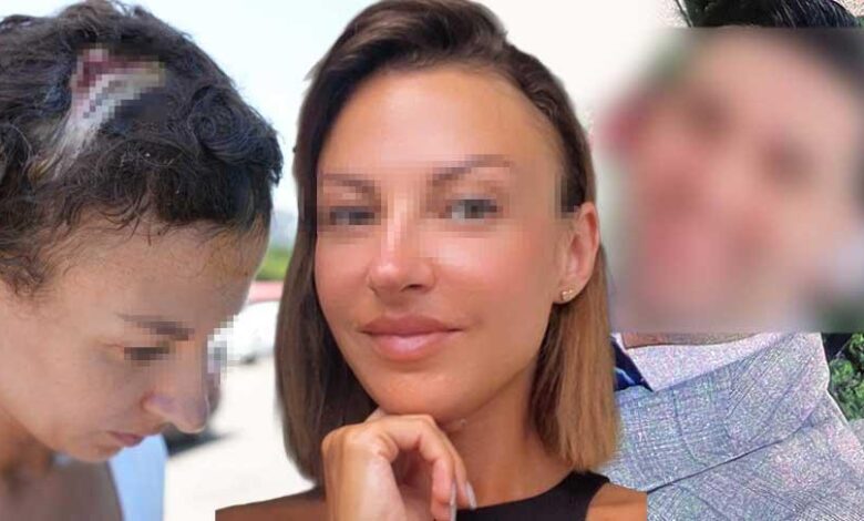 Uzaklaştırma kararı sonrası vahşet! Kafatasına zımba atıldı, elleri kırıldı: Plan yapıp beni öldürmeye geldi 1 uzaklastirma karari sonrasi vahset kafatasina zimba atildi elleri kirildi plan yapip beni oldurmeye geldi QCNqkz7e