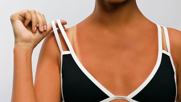 Yazın bronz derili olmak çok moda! ‘Sağlıklı bronzlaşma diye bir şey yok’ 2 yazin bronz derili olmak cok moda saglikli bronzlasma diye bir sey yok 0 8bgvJlpY