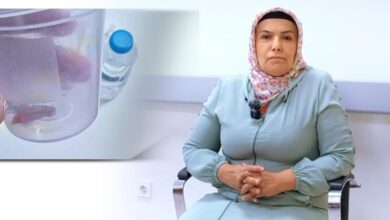 15 yillik oksurugun nedeni saskina cevirdi fmvk3NpT