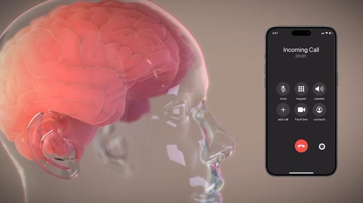 Elon Musk’un Neuralink’i, Ekim’de insan testlerine başlıyor 1 elon muskun neuralinki ekimde insan testlerine basliyor m8dHI4zH