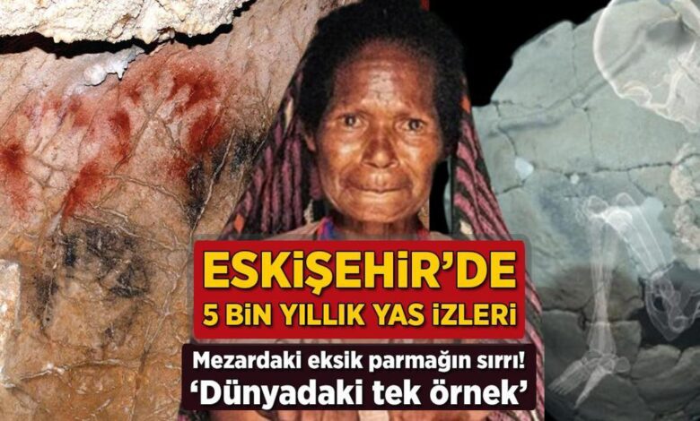 eskisehirde 5 bin yillik yas izleri mezardaki eksik parmagin sirri dunyadaki tek ornek i2hZfhYb