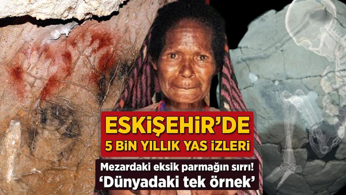 Eskişehir’de 5 bin yıllık yas izleri! Mezardaki eksik parmağın sırrı: ‘Dünyadaki tek örnek’