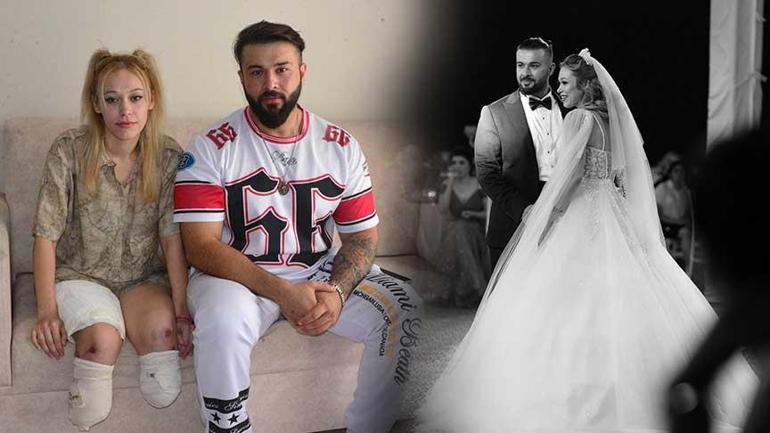 Fitness eğitmeni en keyifli gününde 2 bacağını kaybetti! ‘Evlilik yıl dönümüm cehenneme döndü’ 2 fitness egitmeni en keyifli gununde 2 bacagini kaybetti evlilik yil donumum cehenneme dondu 0 ZjuHtPrd