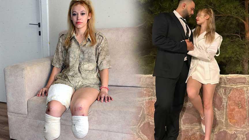 Fitness eğitmeni en keyifli gününde 2 bacağını kaybetti! ‘Evlilik yıl dönümüm cehenneme döndü’