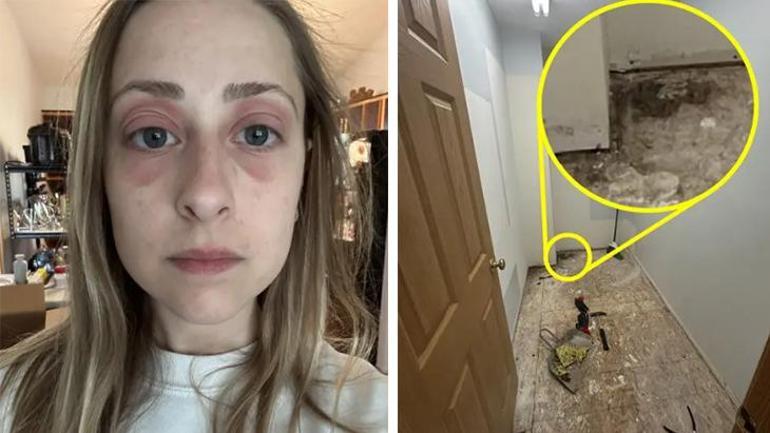 Milyonluk meskende saklı bomba! Fotoğrafla fark edildi: 'Her yere yayılmış, hastayım sandım' 3 milyonluk meskende sakli bomba fotografla fark edildi her yere yayilmis hastayim sandim 1 vPcePNO3