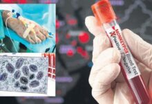 turkiyede mpox argumani fLKRnz3T